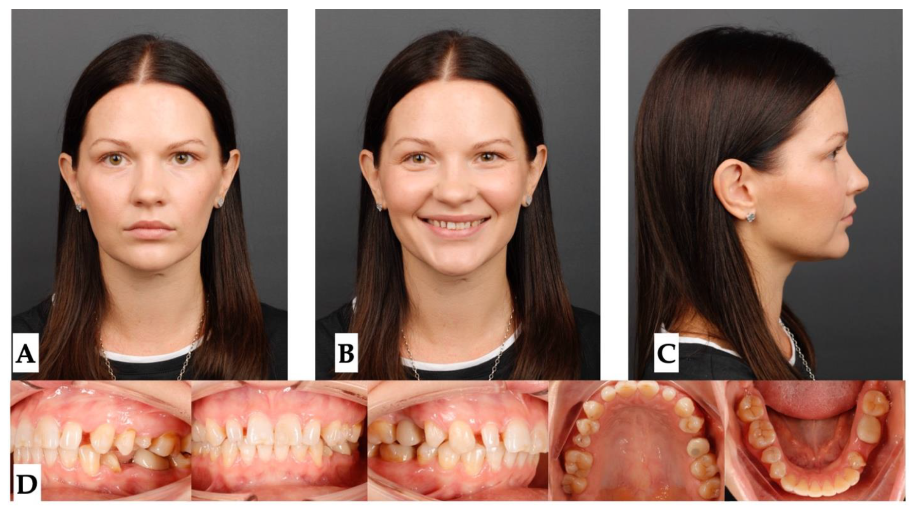 Preprints 177474 g017