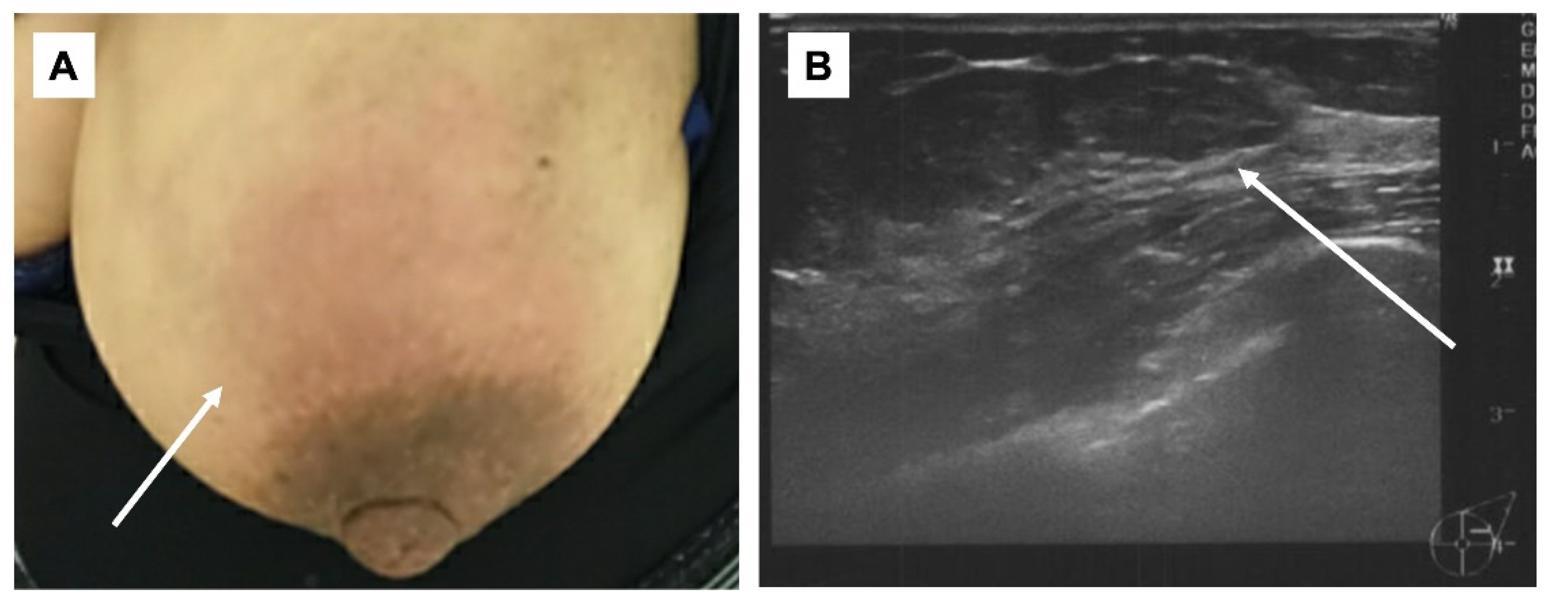 Preprints 79149 g002