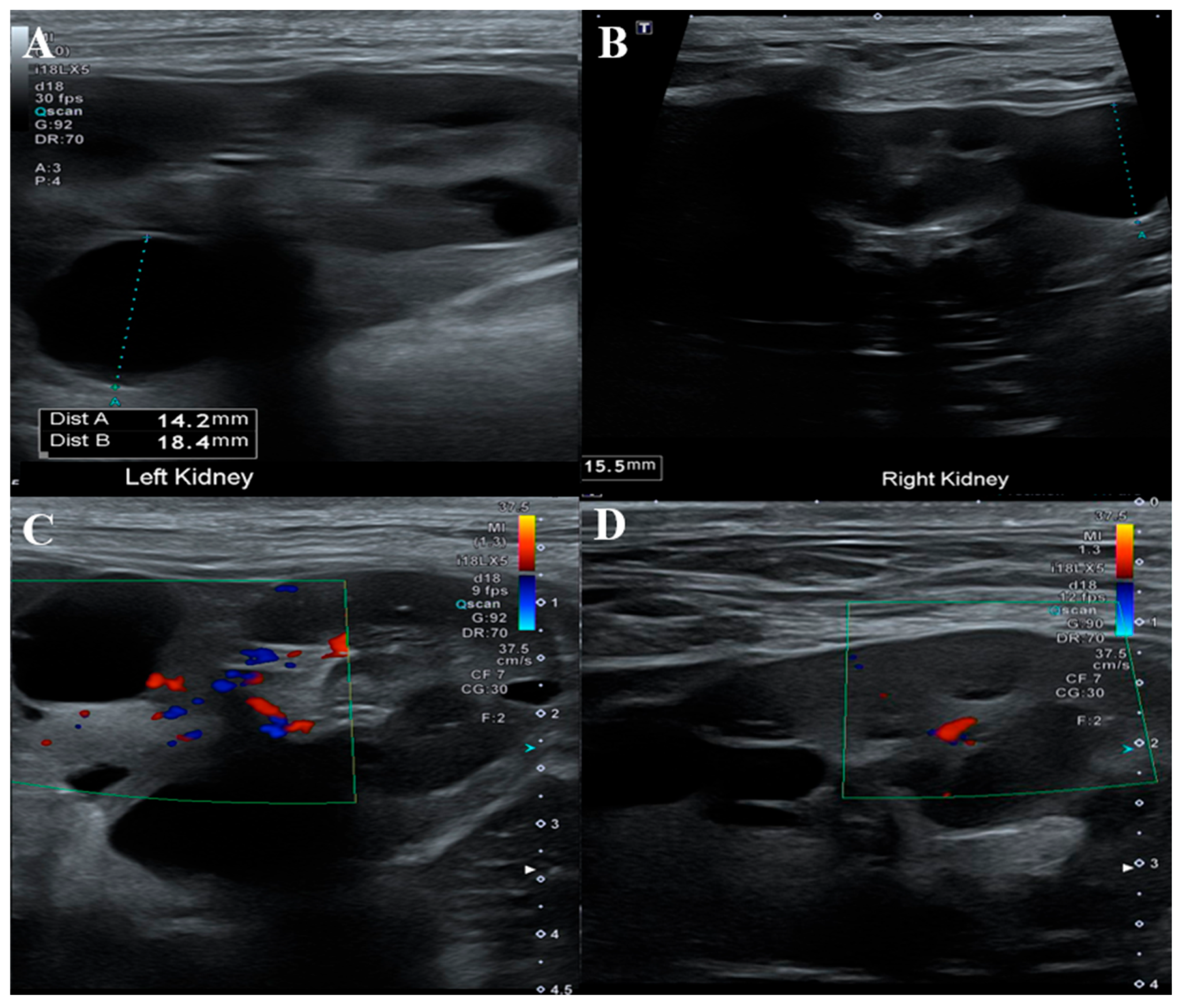 Preprints 163270 g004