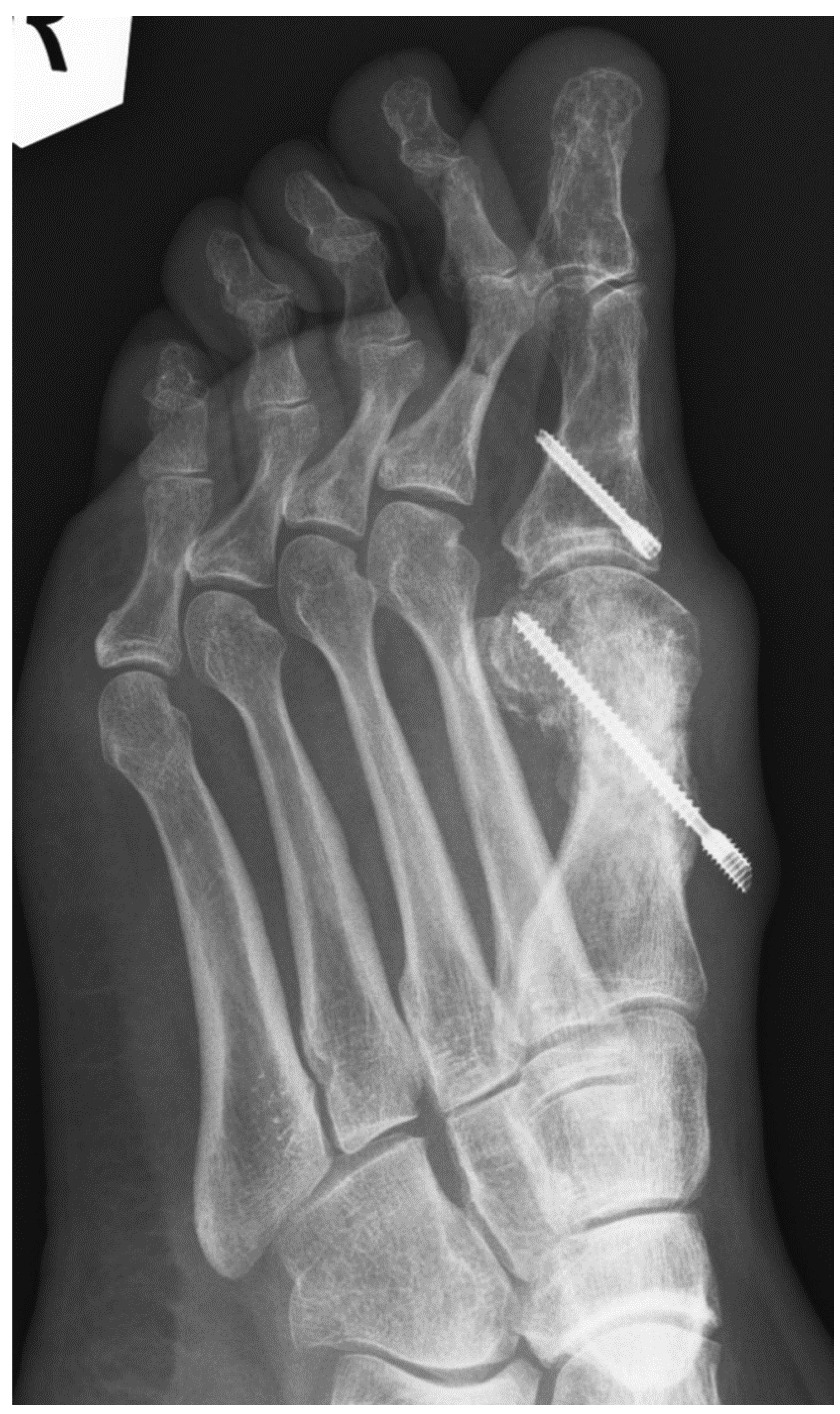 Preprints 195875 g004