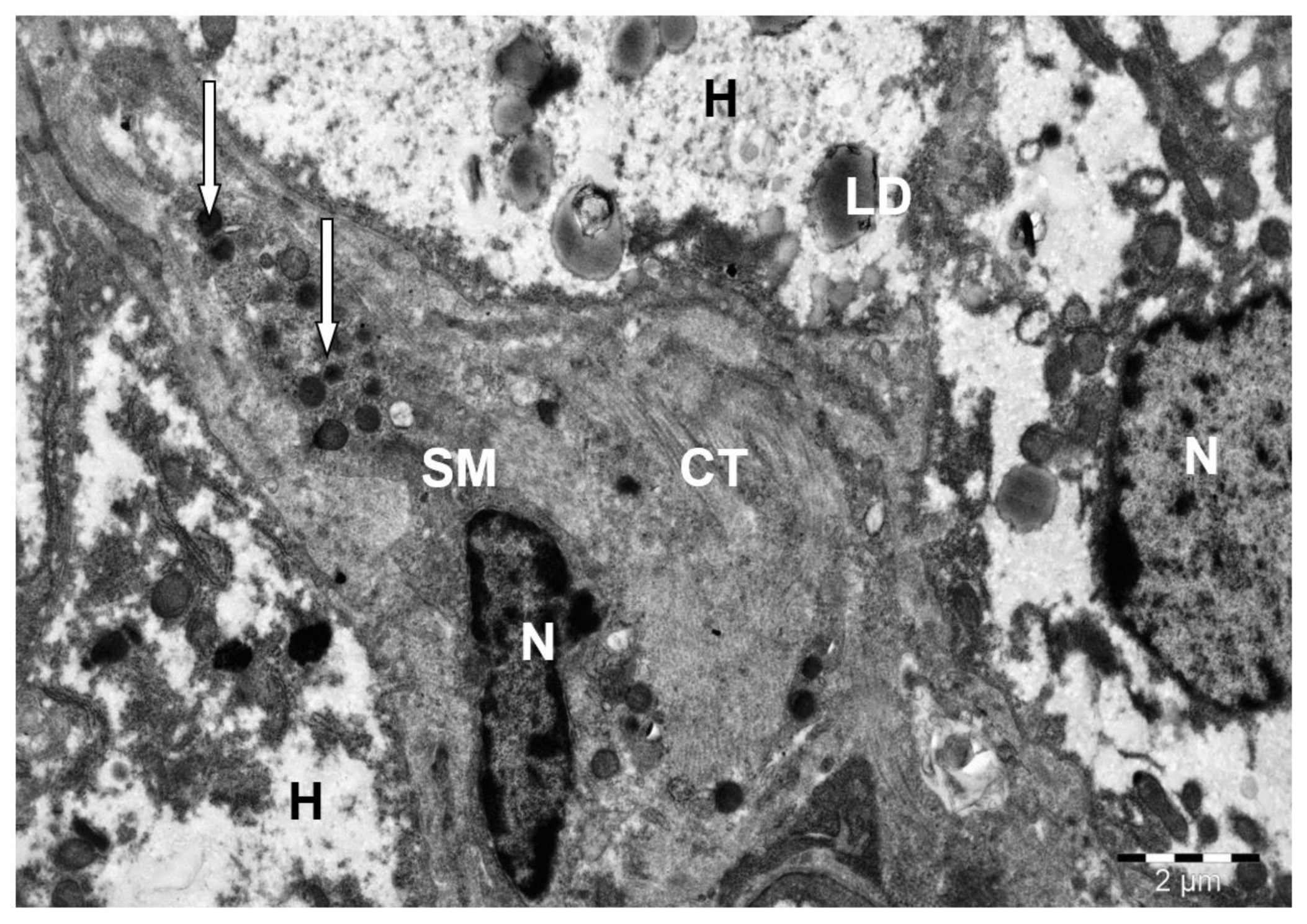 Preprints 172017 g011