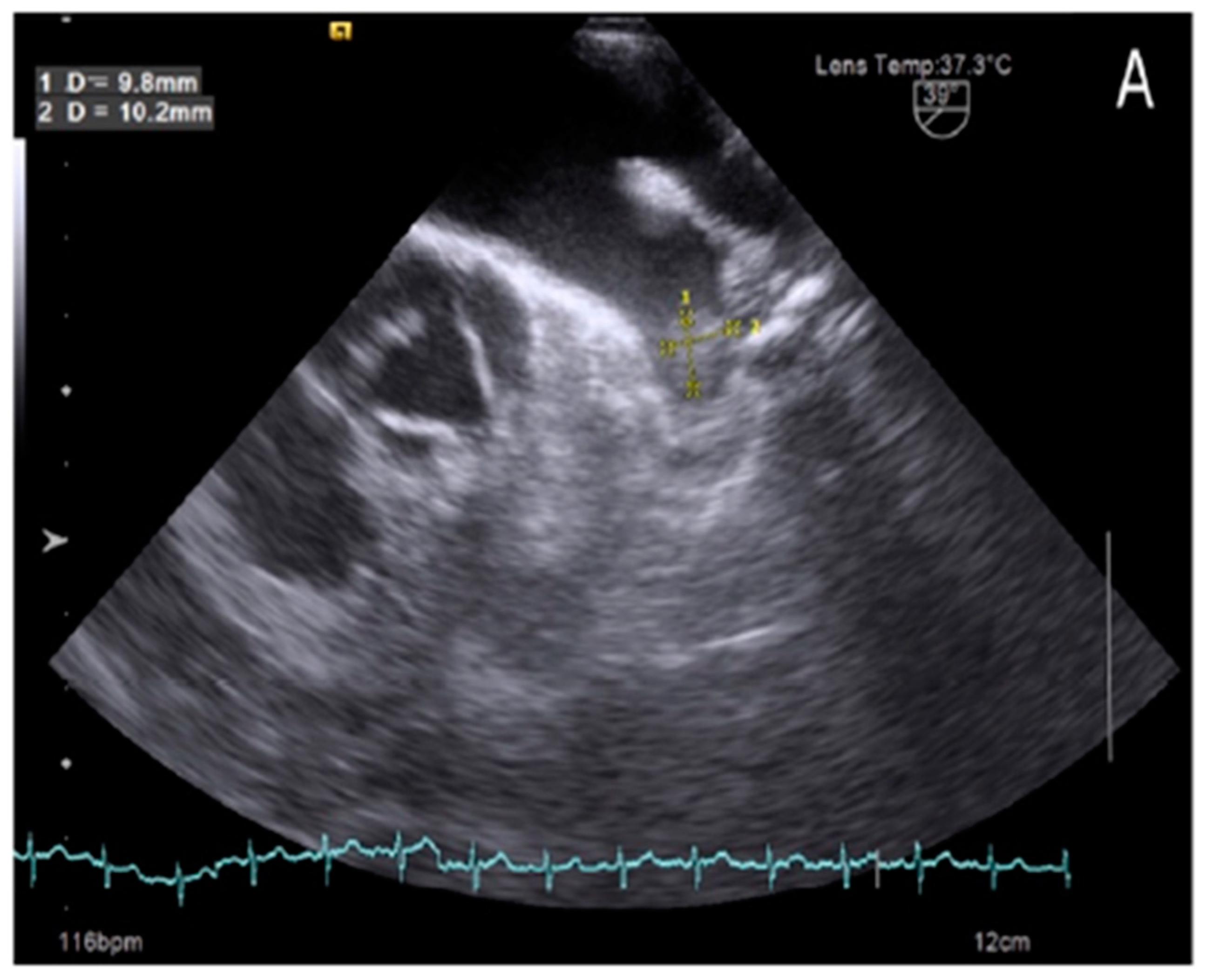 Preprints 154748 g001