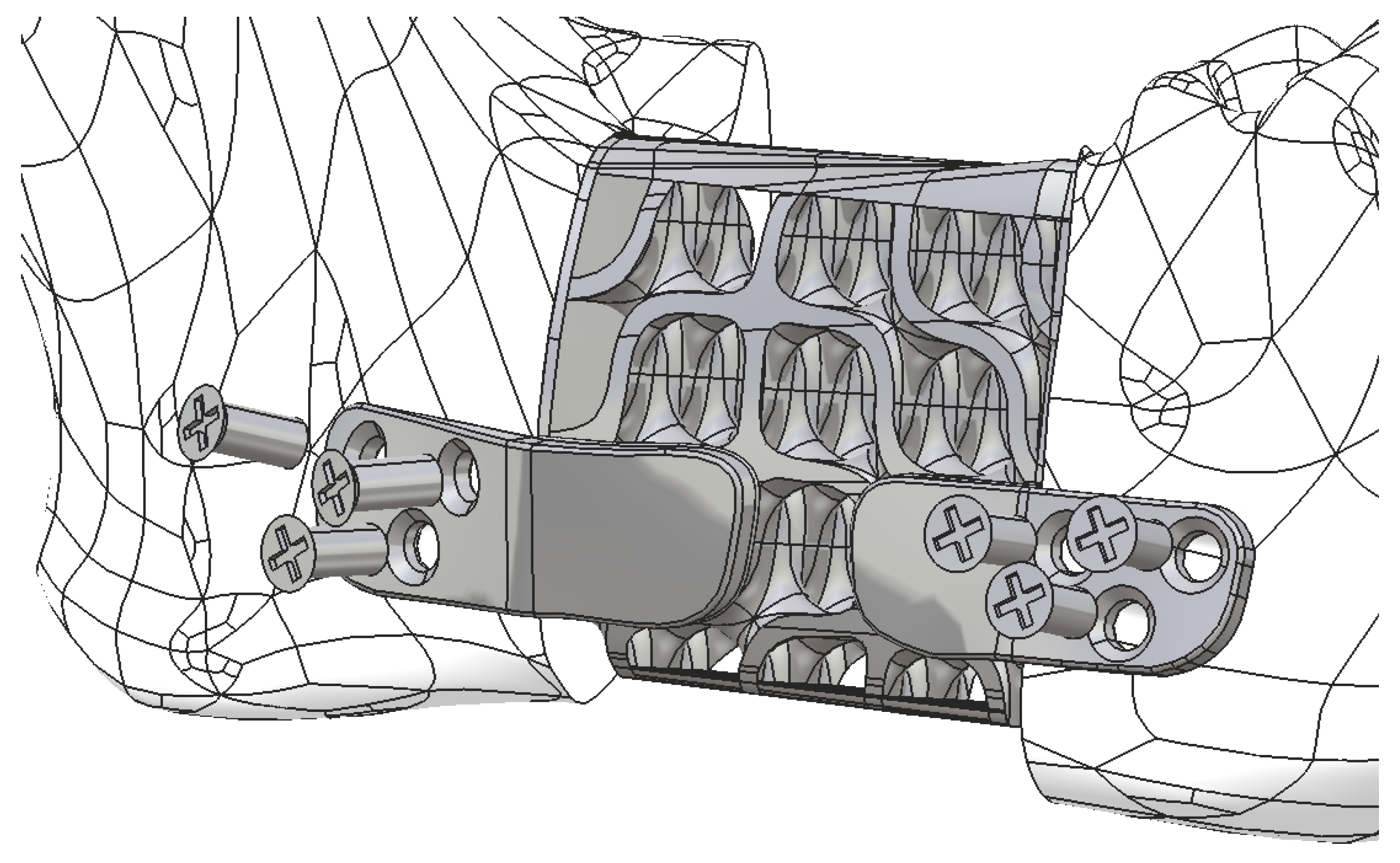 Preprints 151778 g014