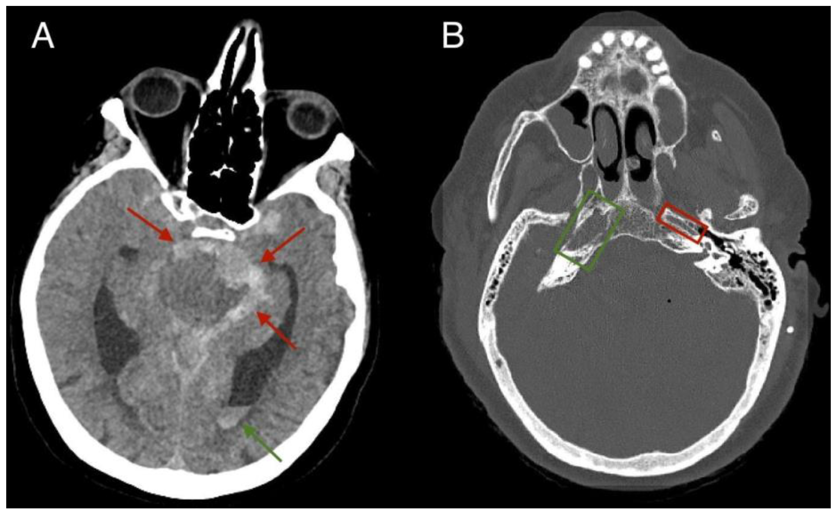Preprints 146187 g001