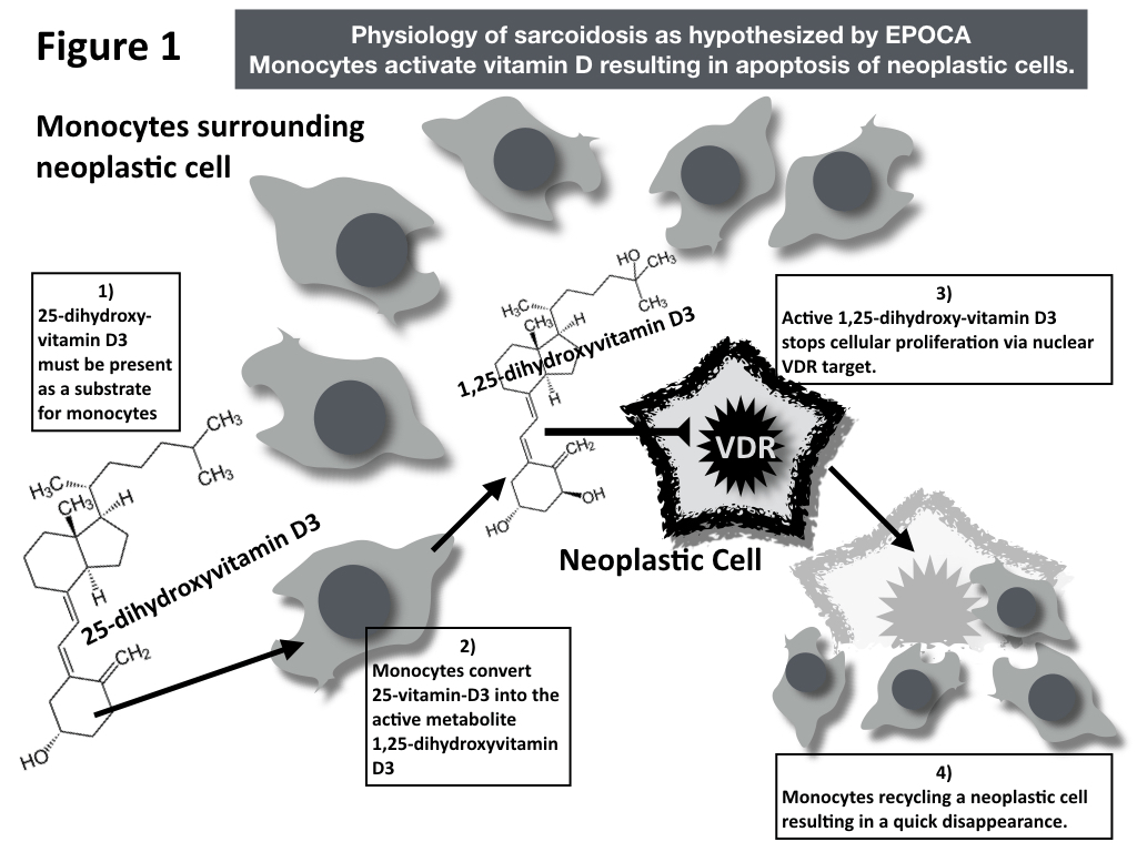 The Hypercalcemic Effect of Vitamin D3 in Sarcoidosis Could Be a Side