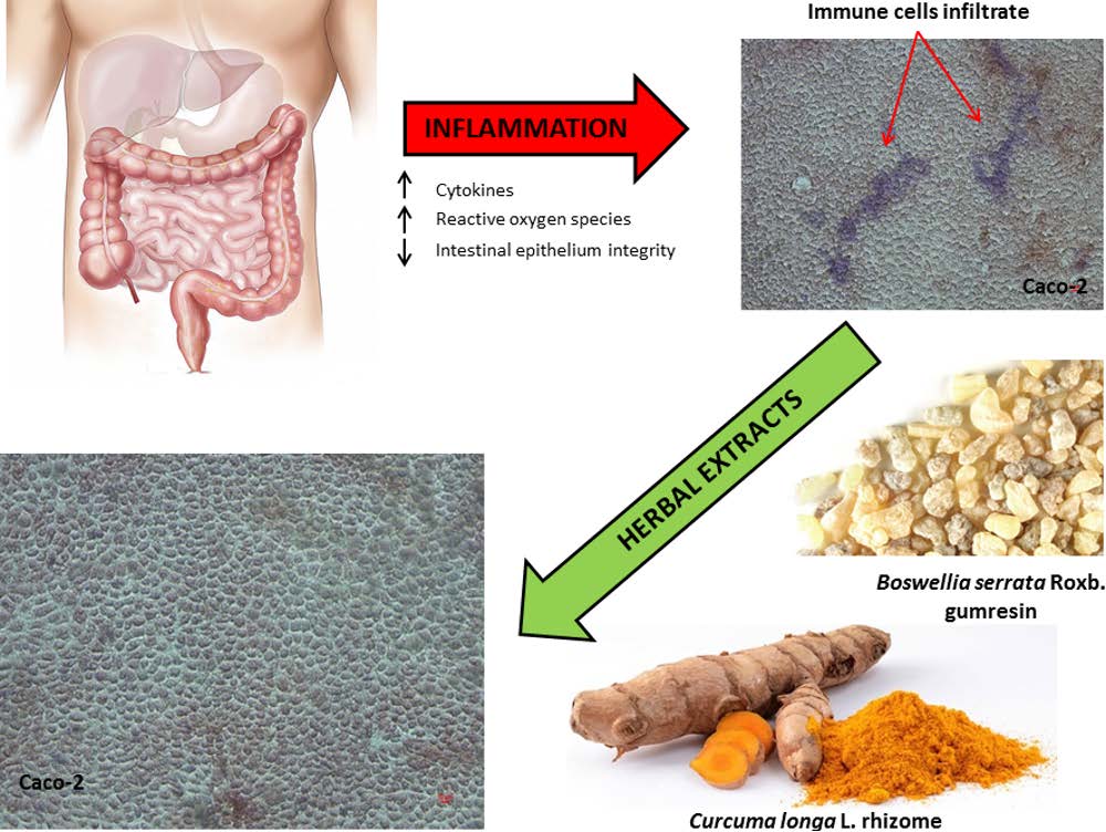 Effects Of Boswellia Serrata Roxb And Curcuma Longa L In An In Vitro Intestinal Inflammation Model Using Immune Cells And Caco 2 V2 Preprints