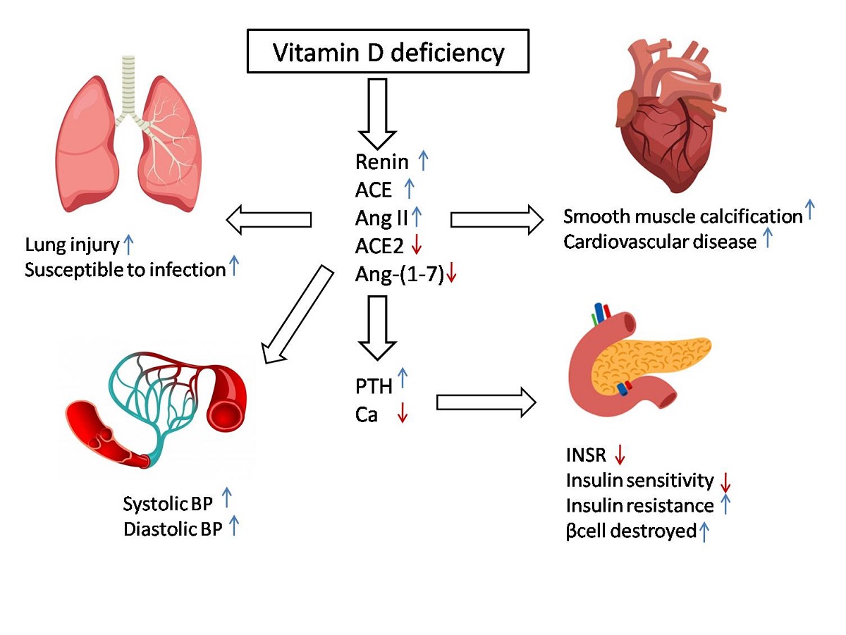 Role Of Vitamin D In Pathogenesis And Severity Of Covid 19 Infection V1 Preprints