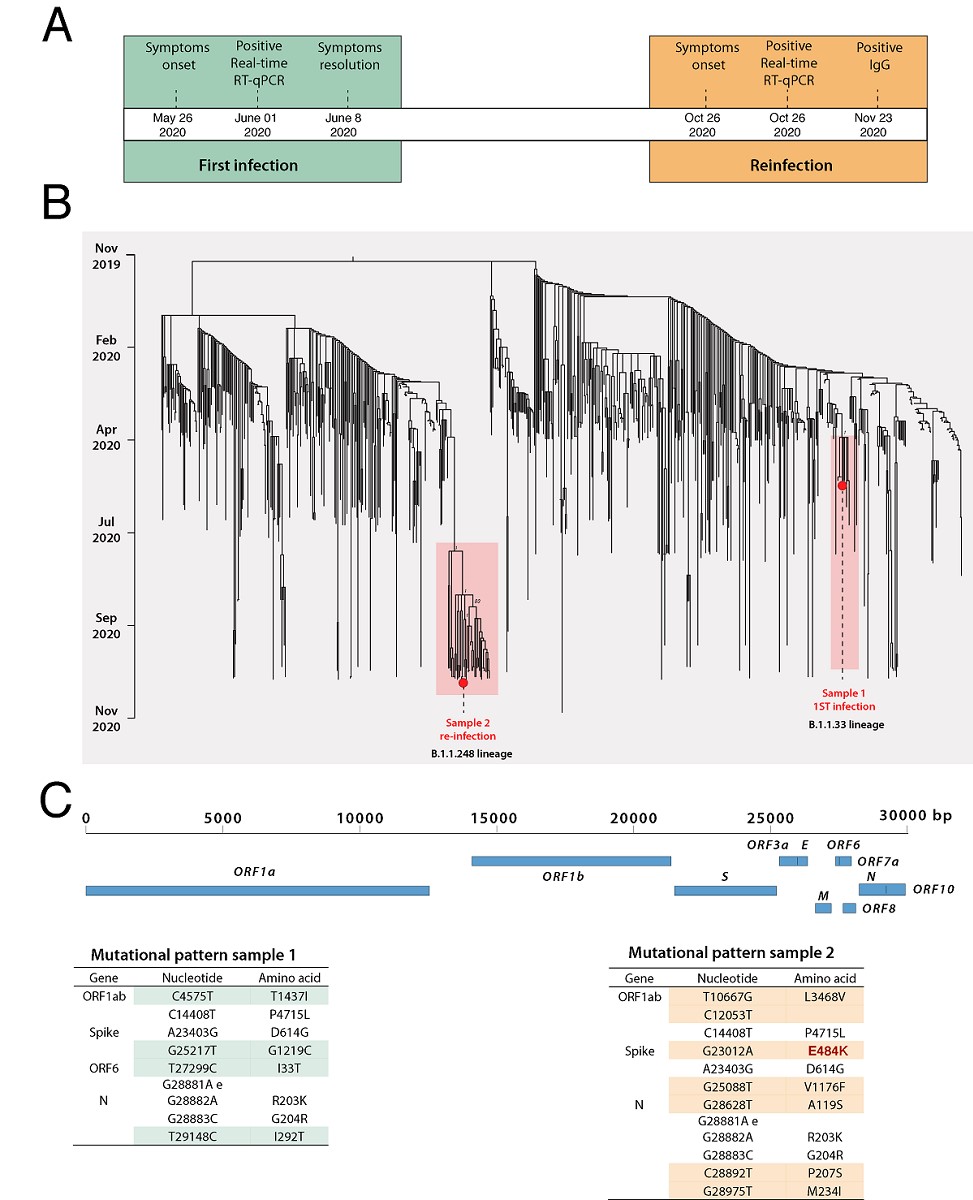 Genomic Evidence Of A Sars Cov 2 Reinfection Case With E484k Spike Mutation In Brazil V1 Preprints