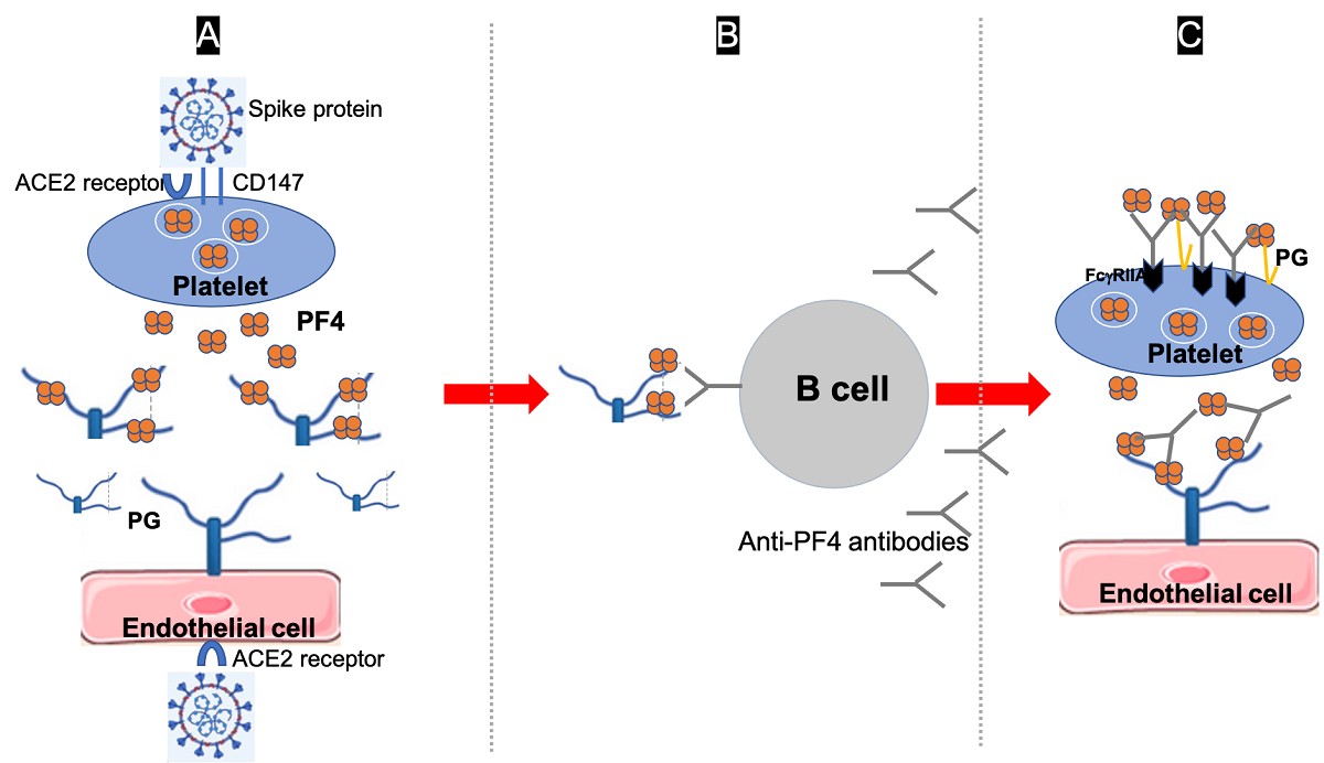 Autoimmune Thrombotic Thrombocytopathy Associated With Covid 19 Infection Or Vaccination Learning From Heparin Induced Thrombocytopenia V1 Preprints