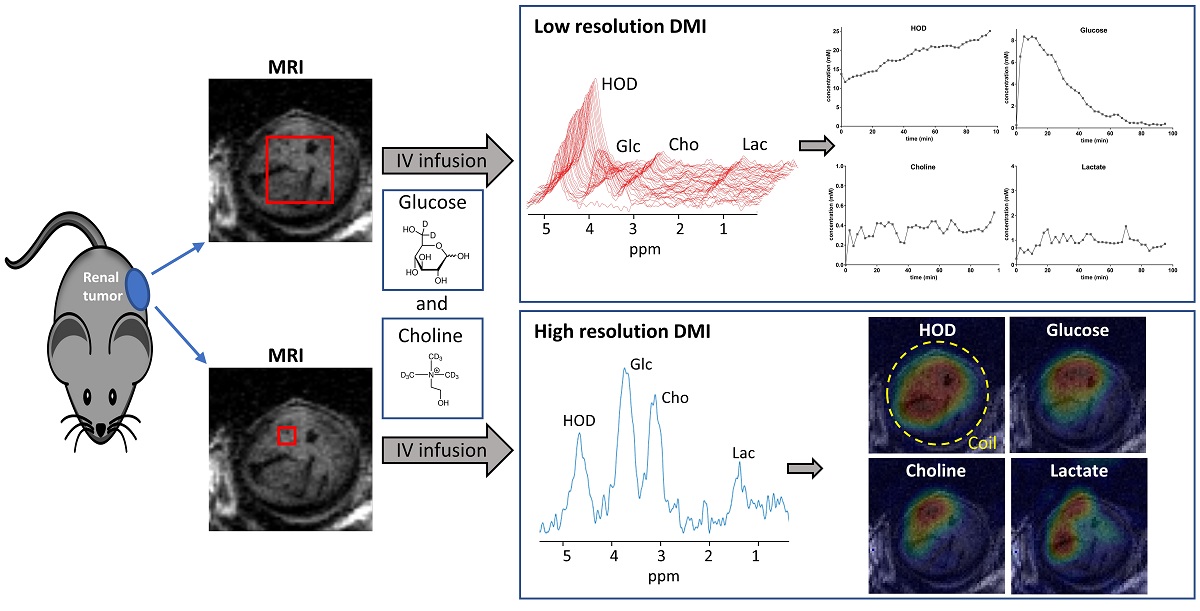 Simultaneous Recording Of The Uptake And Conversion Of Glucose And Choline In Tumors By Deuterium Metabolic Imaging Dmi V1 Preprints